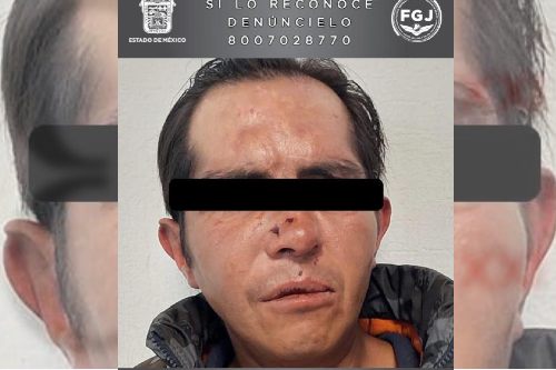 Con una agujeta, este sujeto estranguló a un peludito en Ecatepec